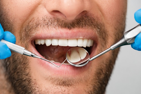 Cavity Treatment: Three Reasons Not To Put It Off