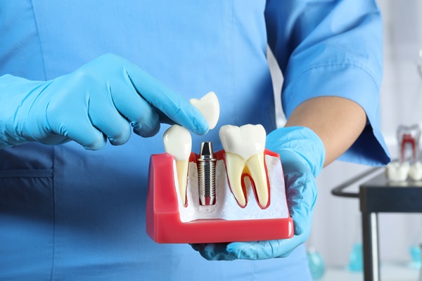 How A Restorative Dentist Can Improve Your Oral Health