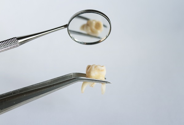 Can A General Dentist Perform A Tooth Extraction?